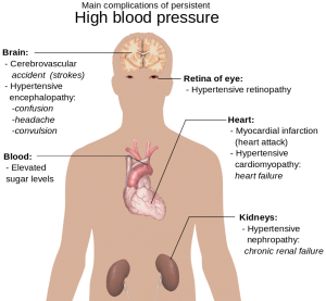 high blood pressure complications diagram