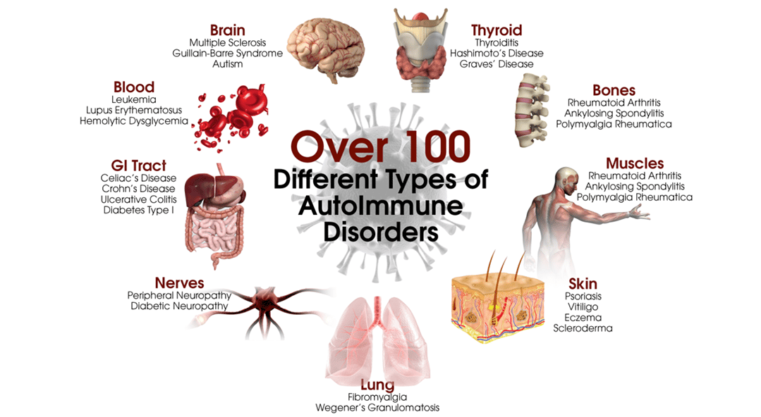 SYMPTOMS OF A MALFUNCTIONING IMMUNE SYSTEM