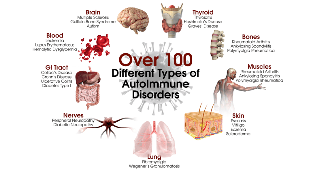 Autoimmune Diseases