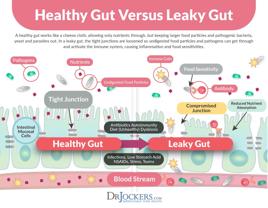 healthy gut vs leaky gut