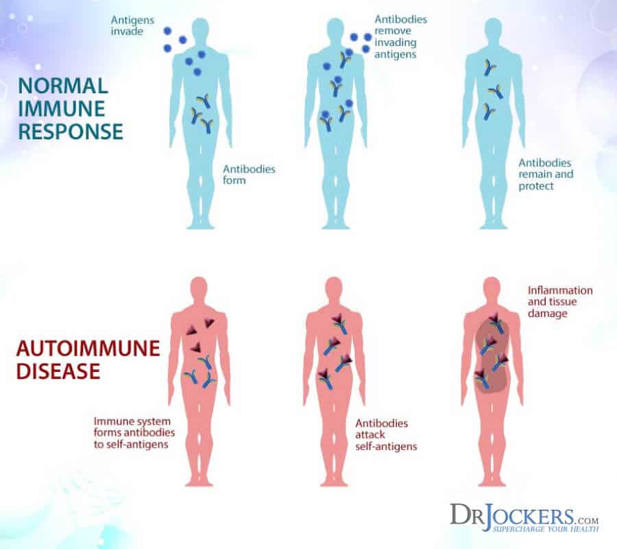 immune response